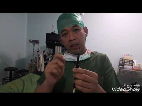 Video: Tonsilektomi: Tujuan, Prosedur, Dan Pemulihan