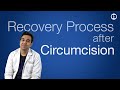 Circumcision Recovery Process Circumcision Karane Ke Baad Kya Hota Hai Precautions After Surgery 