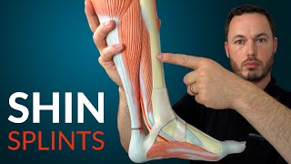 Understanding SHIN SPLINTS and how to fix it.