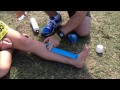 Running - Taping to Ease Shin Splints - Running Injury Free Revolution (RIF REV)