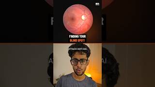 how to find your blind spot!