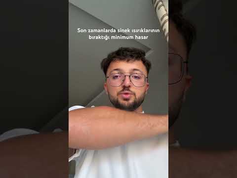 Önceden sadece kaşınırdı şimdi…