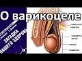 О варикоцеле - Петренко Валентина Васильевна