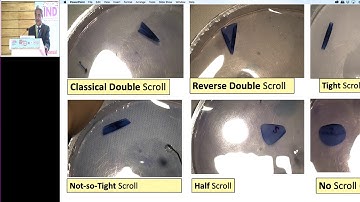 AIOC2019   IC579   Topic   DMEK demystified   Dr Samar Kumar Basak