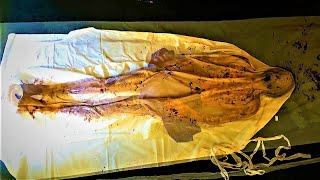 How Jesus Was Wrapped In Shroud of Turin