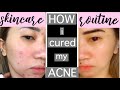 HOW TO GET  RID OF ACNE AND SCARS FAST | Updated skincare routine