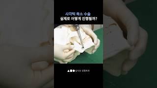사각턱 축소 수술 실제로 어떻게 진행될까?