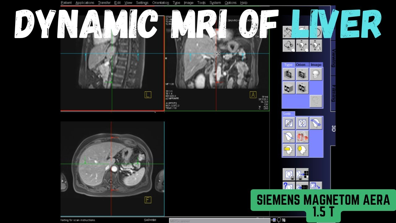 DYNAMIC MRI OF LIVER | TRI-PHASE LIVER MRI | SIEMENS MAGNETOM AERA 1.5 T | DYNAMIC CONTRAST LIVER |