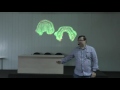 «Как 3D в стоматологии изменяет жизнь» Алексей Красножон