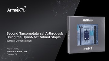 Second Tarsometatarsal Arthrodesis Using the DynaNite™ Nitinol Staple