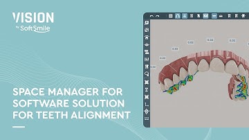 Narrated Demo: Space Manager for Software Solution for Teeth Alignment