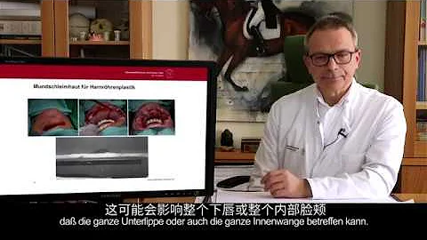 男性重建尿道(输尿管）无需切除口腔黏膜，德国教授G.Lauer介绍尿道扩张新疗法Mukocell组织细胞再生技术的运用 - 天天要闻