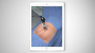 Touch Surgery Simulation - Laparoscopic TAPP Inguinal Hernia Repair screenshot 5