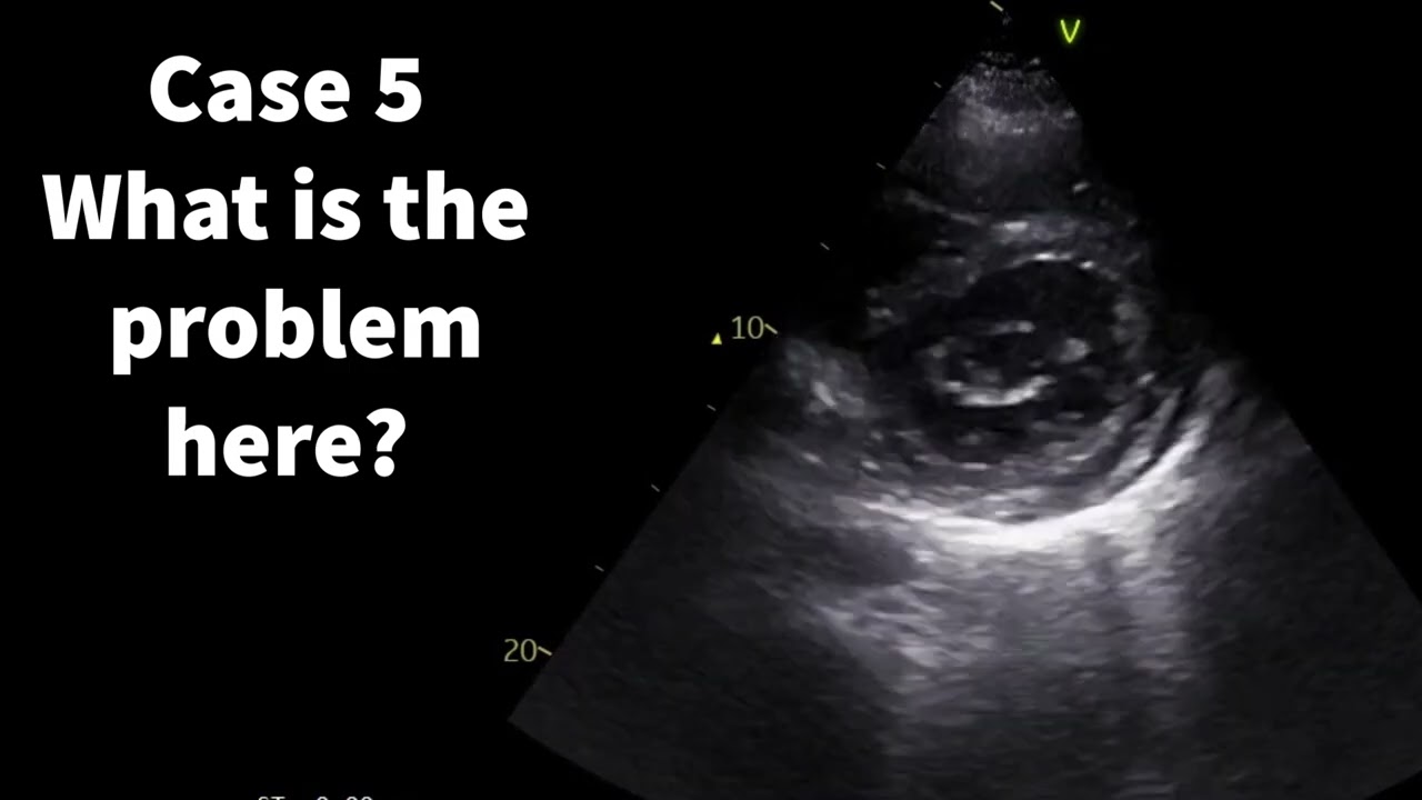 2D ECHO pop quiz: Test your knowledge