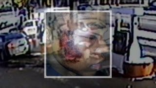 Man claims he was beaten by police over gum