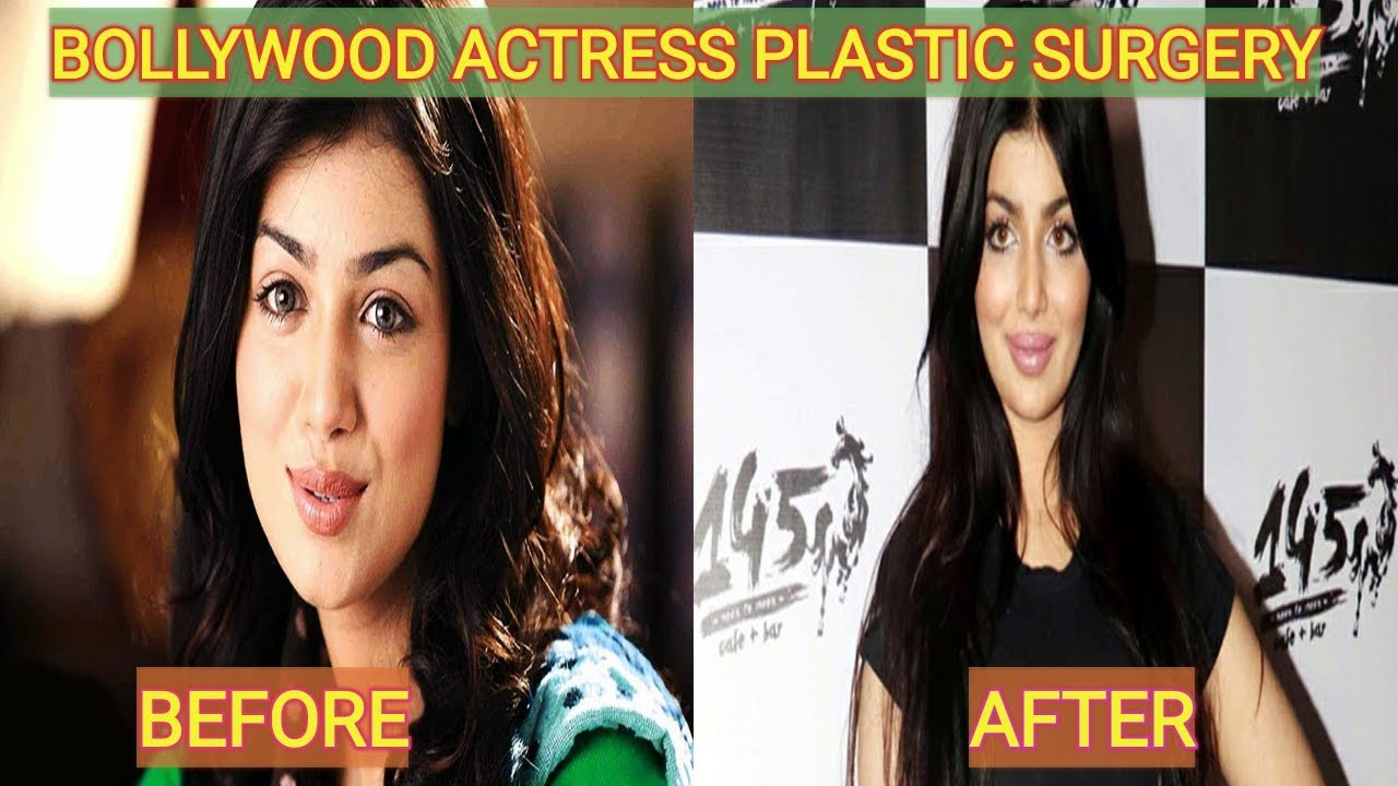 BOLLYWOOD actress before and after plastic surgery.. YouTube