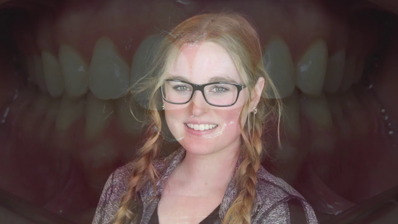 Whitlock Orthodontics | Fayetteville, AR Invisalign & Braces Orthodontist | Springdale, AR