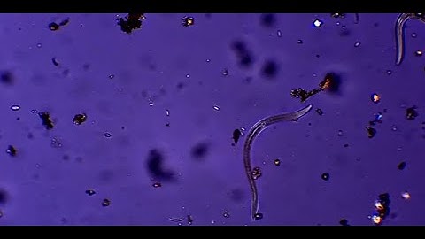 Parasitism by root knot nematodes is linked to increased nitrogen fixation in the root microbiome