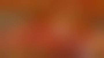 Robotic Sentinel Node Biopsy (SNB) for Endometrial Cancer by Dr Sandeep Nayak