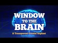 UCR - SOMBRERO - Window to the Brain