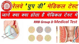 RRB group d medical test screenshot 5