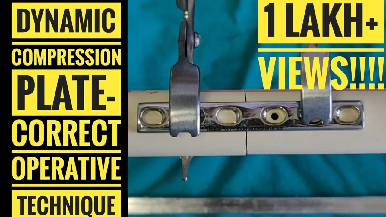 Dynamic Compression Plate (DCP)- Correct Operative Technique 