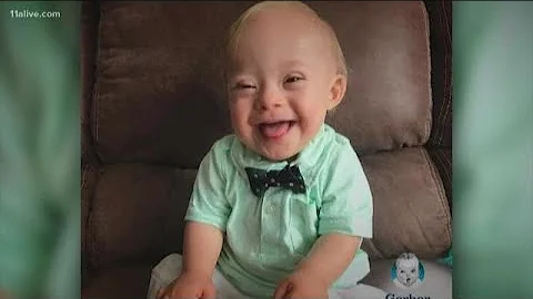 'Any child can be beautiful': Lucas Warrens parent...