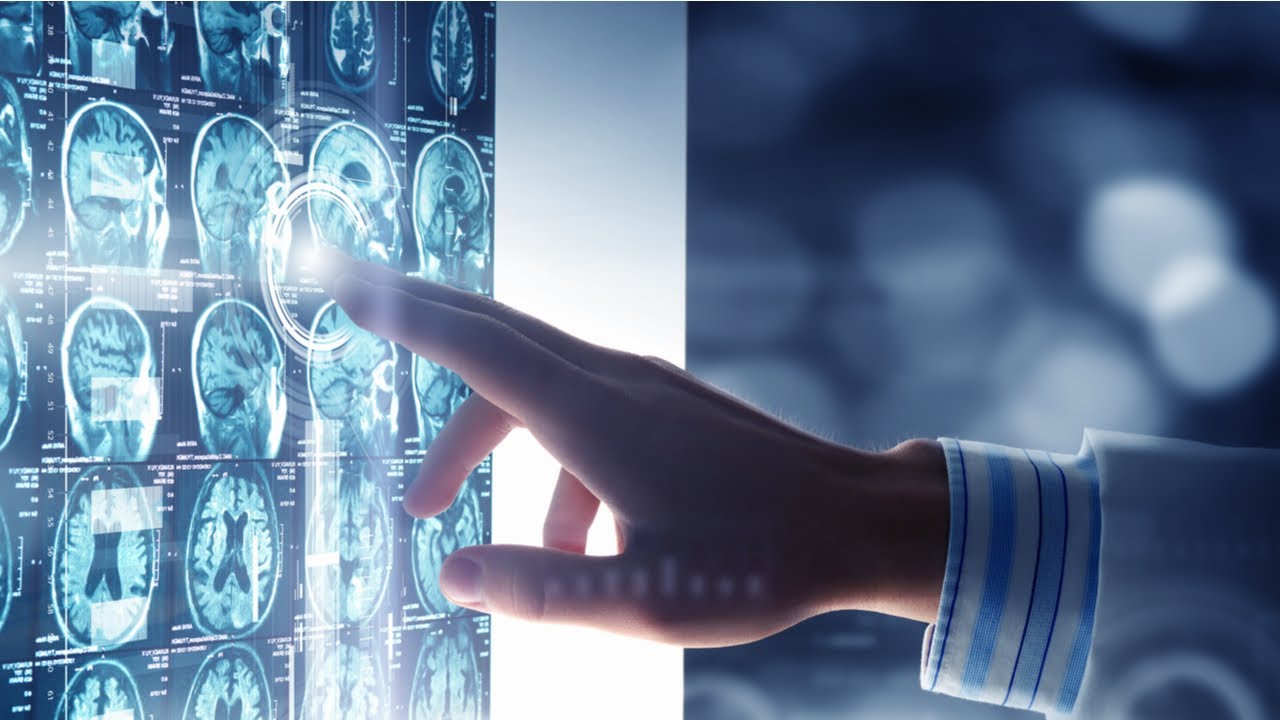 תובנת ההמונים וחקר העתיד: הנוירופיזיולוגיה של המוח - פרופ' דוד פסיג