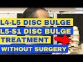 L4-L5 and L5-S1 Discs Bulge Treatment without Surgery | Chiropractor in Vaughan Dr. Walter Salubro
