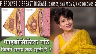 फाइब्रोसिस्टिक ब्रेस्ट क्या है, जानिए इसके लक्षण और उपचार - Fibrocystic Breast Disease screenshot 5
