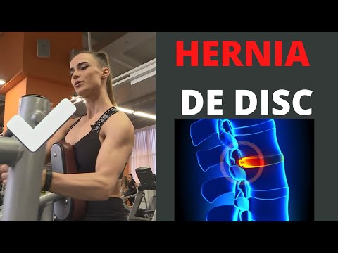 Video: 3 moduri de prevenire a herniei