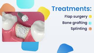 Loose Teeth And Their Early Correction Dr. Sudhakar Reddys Dental Implant Studio Bangalore