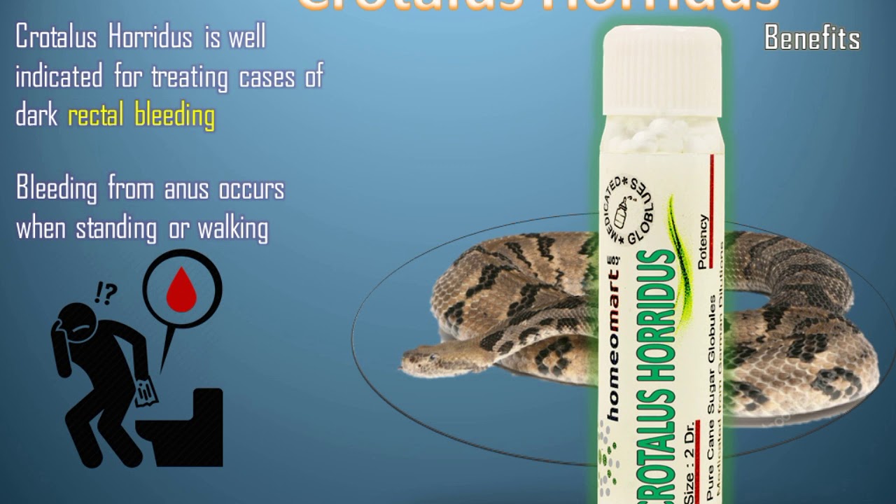Crotalus Horridus Homeopathic Medicine Uses Indications Homeopathic Medicine Homeopathic Homeopathy Treatment