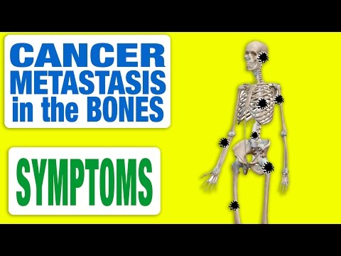 Cancer Metastasis in the Bones - All Symptoms