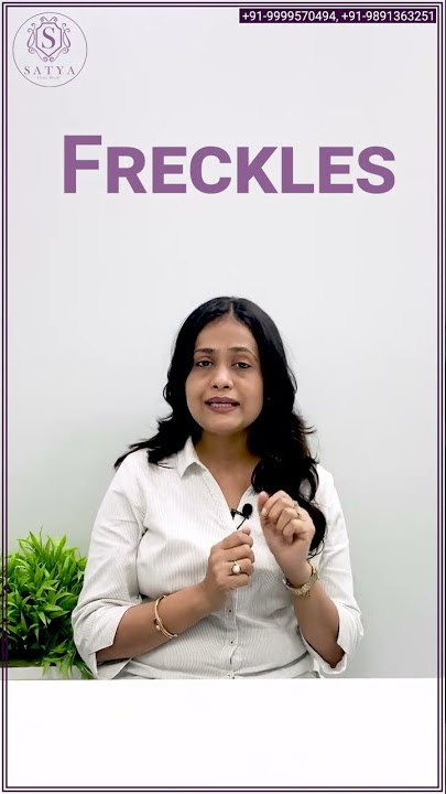 Freckles Treatment | Amazing Facts about Freckles
