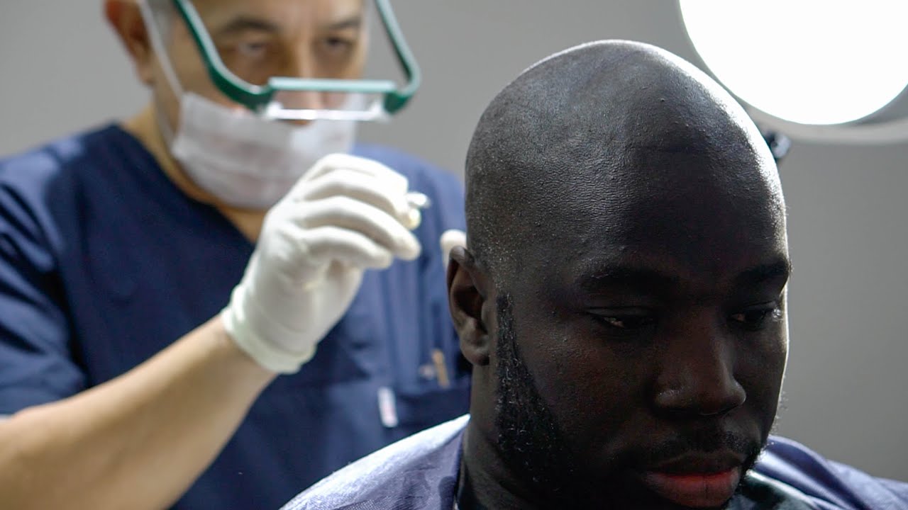 hair-transplant-blue-magic-group-istanbul-youtube