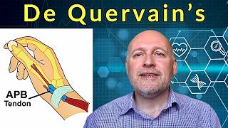 De Quervain's (Mommy Thumb) & Intersection Syndrome. Self Help, Advice and Treatment.