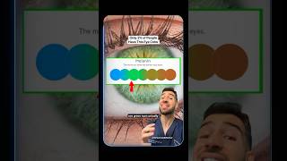 Green Eyes Aren’t Green? Doctor Explains