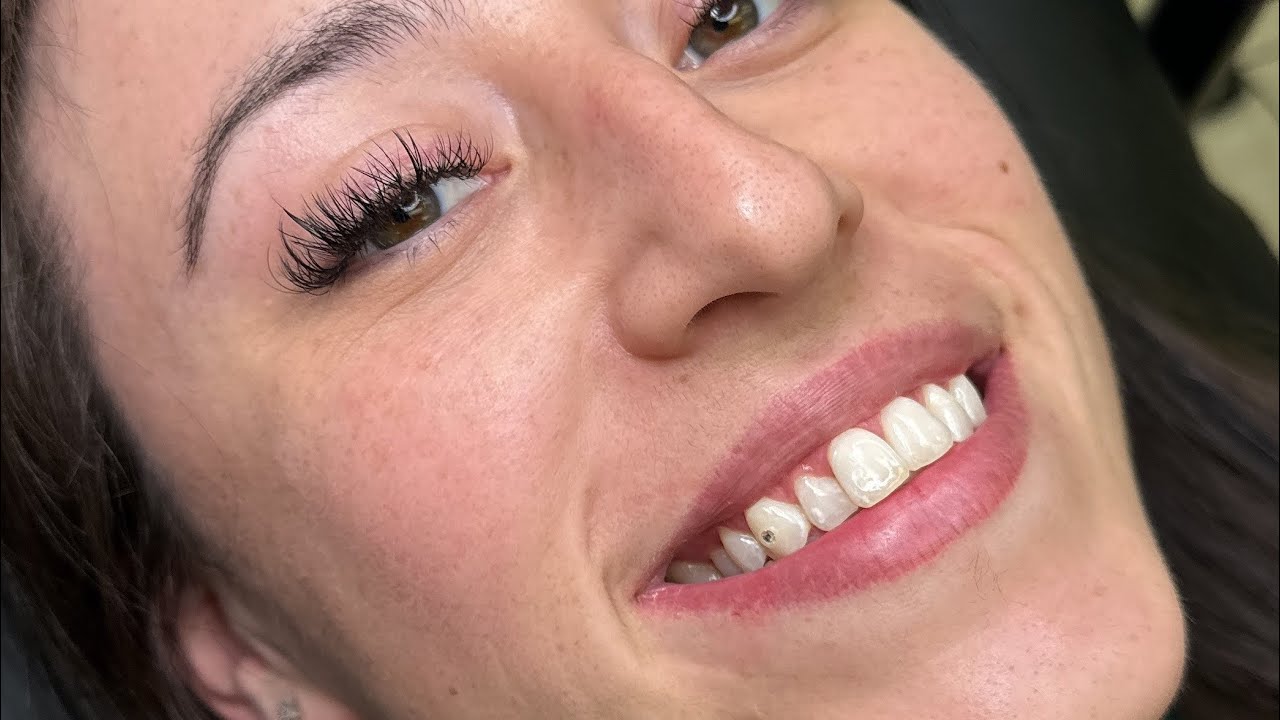 One way to show your clients what size tooth gem works best for their teeth.