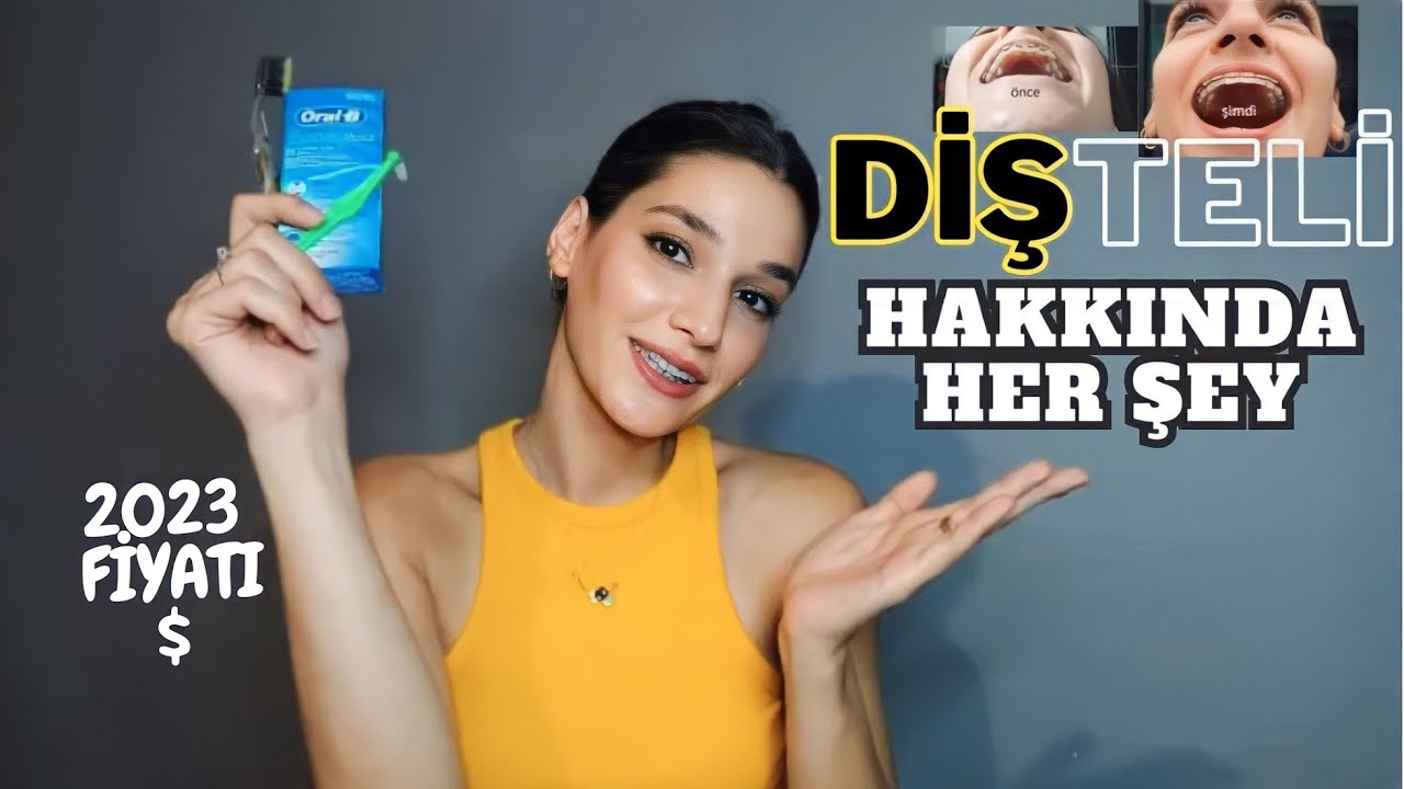 DİŞ TELİ SÜRECİM | Diş Teli Fiyatı, Diş Teli Temizliği, Yeme İçme
