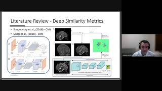 Improving Similarity Metric of Multi-modal MR Brain Image Registration Via a Deep Ensemble