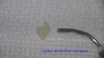 3M Supreme flowable restorative-dispensing test