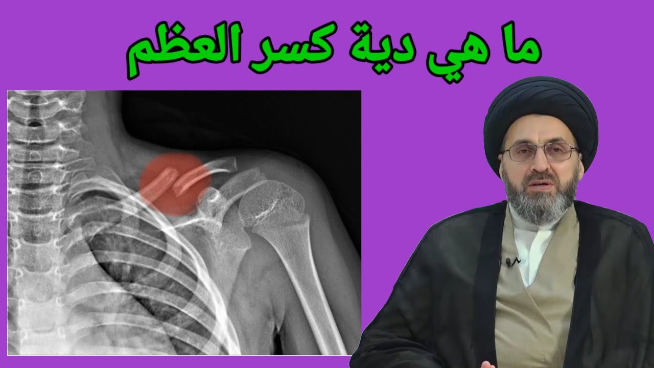 ما هي دية كسر العظام في الاسلام / سماحة السيد رشيد الحسيني