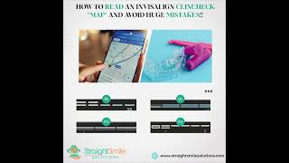 Passive Invisalign Aligners, VPC Aligners- Reading your Clincheck Navigation