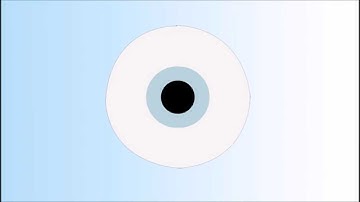 Hyperopia Explained   Annimated Video