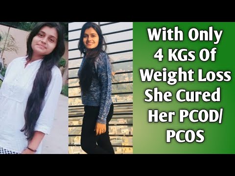 How She Cured PCOD/PCOS With Only 4 Kgs of Weight Loss ?