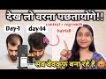ThriveCo Anti Grey Hair Serum Review | Thriveco Serum for Grey Hair | ThriveCo Anti Grey Hair serum