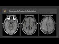 Cómo describir una RM de Cerebro