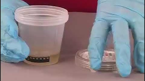 CLIA Waived Drug Test Procedure Video