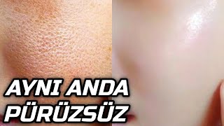 5 DAKİKADA GÖZENEK YOK EDİCİ ! MUTFAKTAKİ TUZA BUNU EKLEYİN FARKI GÖRÜN  - GÜZELLİK SIRLARI